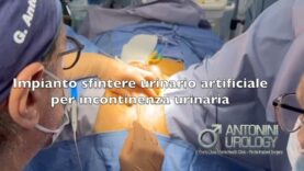 Impianto sfintere urinario artificiale per incontinenza urinaria